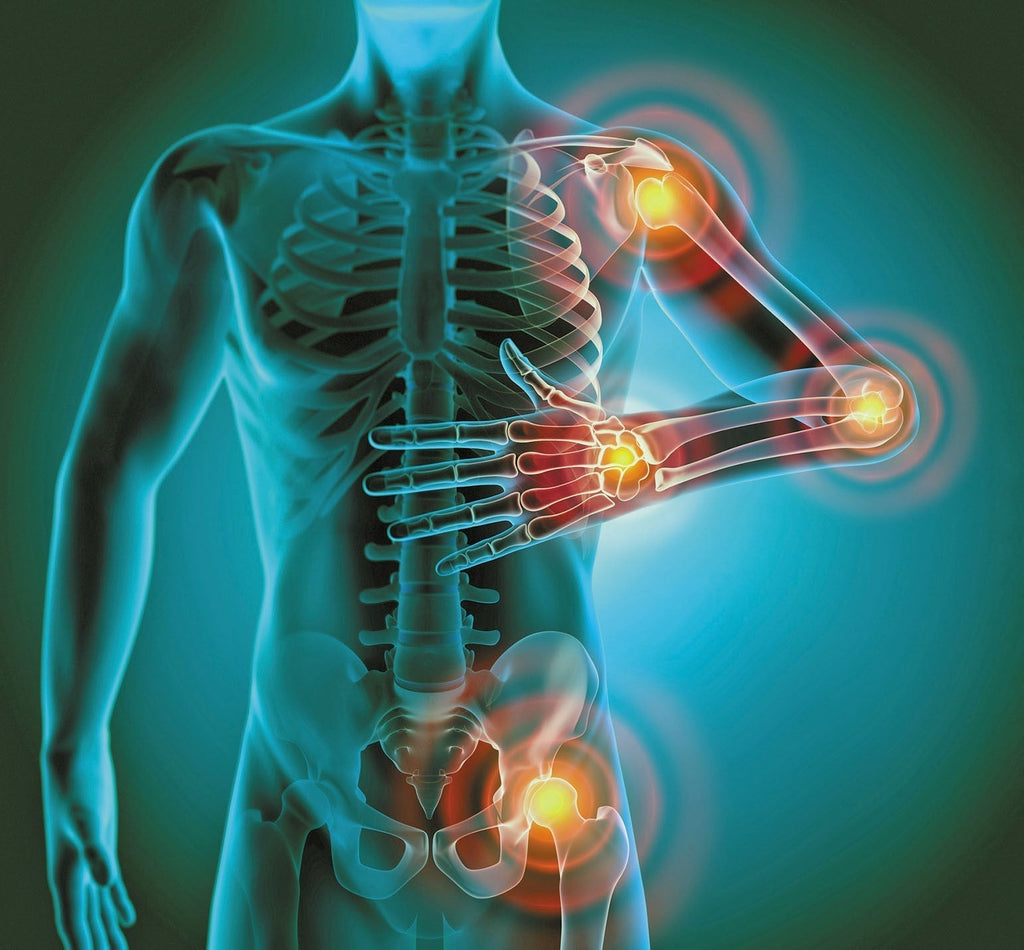 Nattokinase and Bromelain: The Natural Duo for Inflammation Support